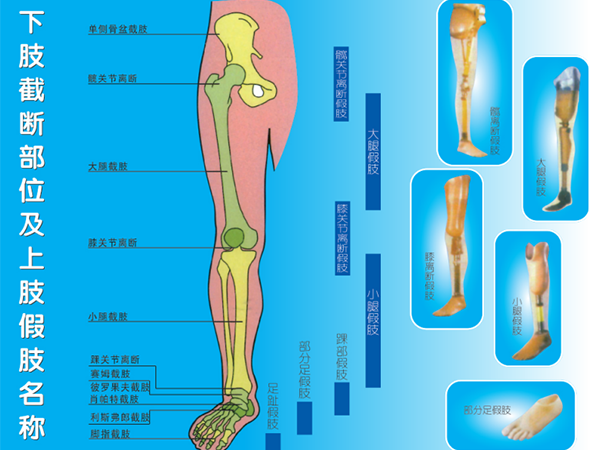 下肢假肢