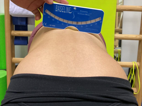 脊柱侧弯的康复治疗