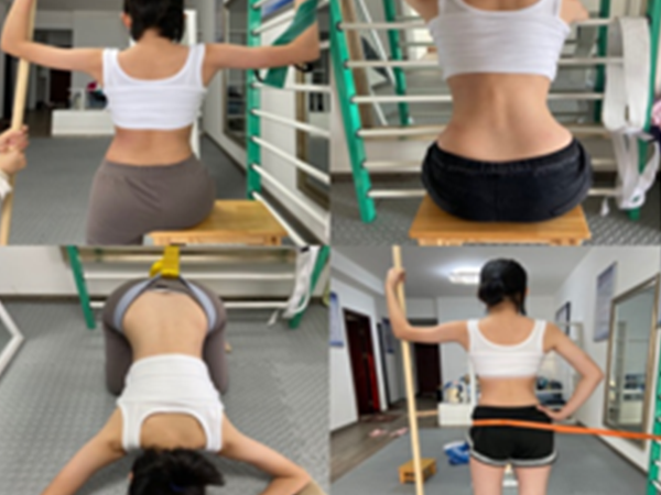 脊柱侧弯的康复治疗