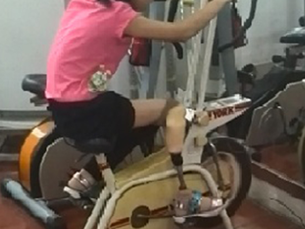儿童假肢