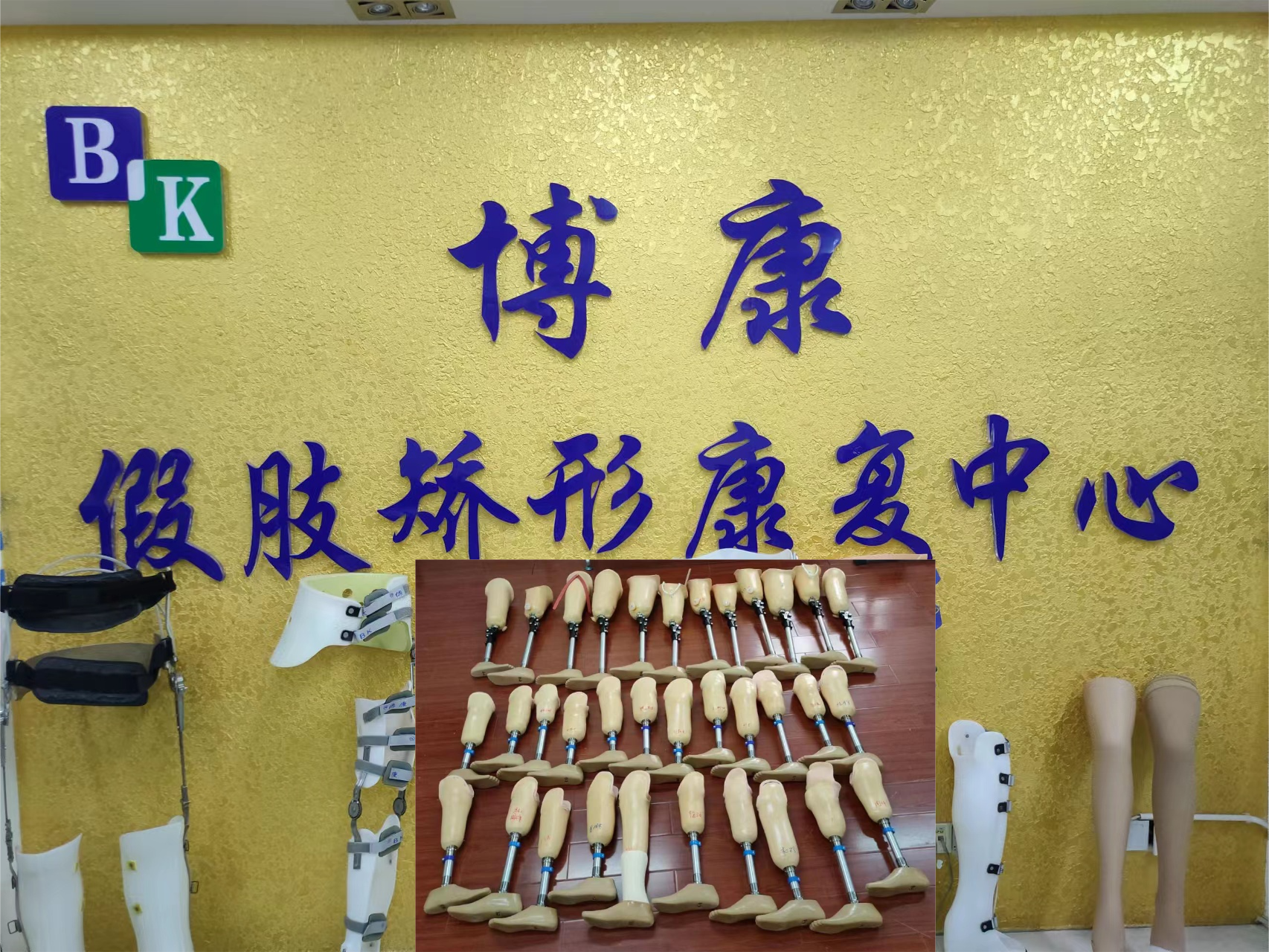 我中心圆满完成湖南省残联（2022）假肢项目益阳地区的假肢装配